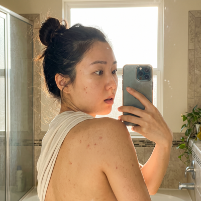 Fewer new breakouts
